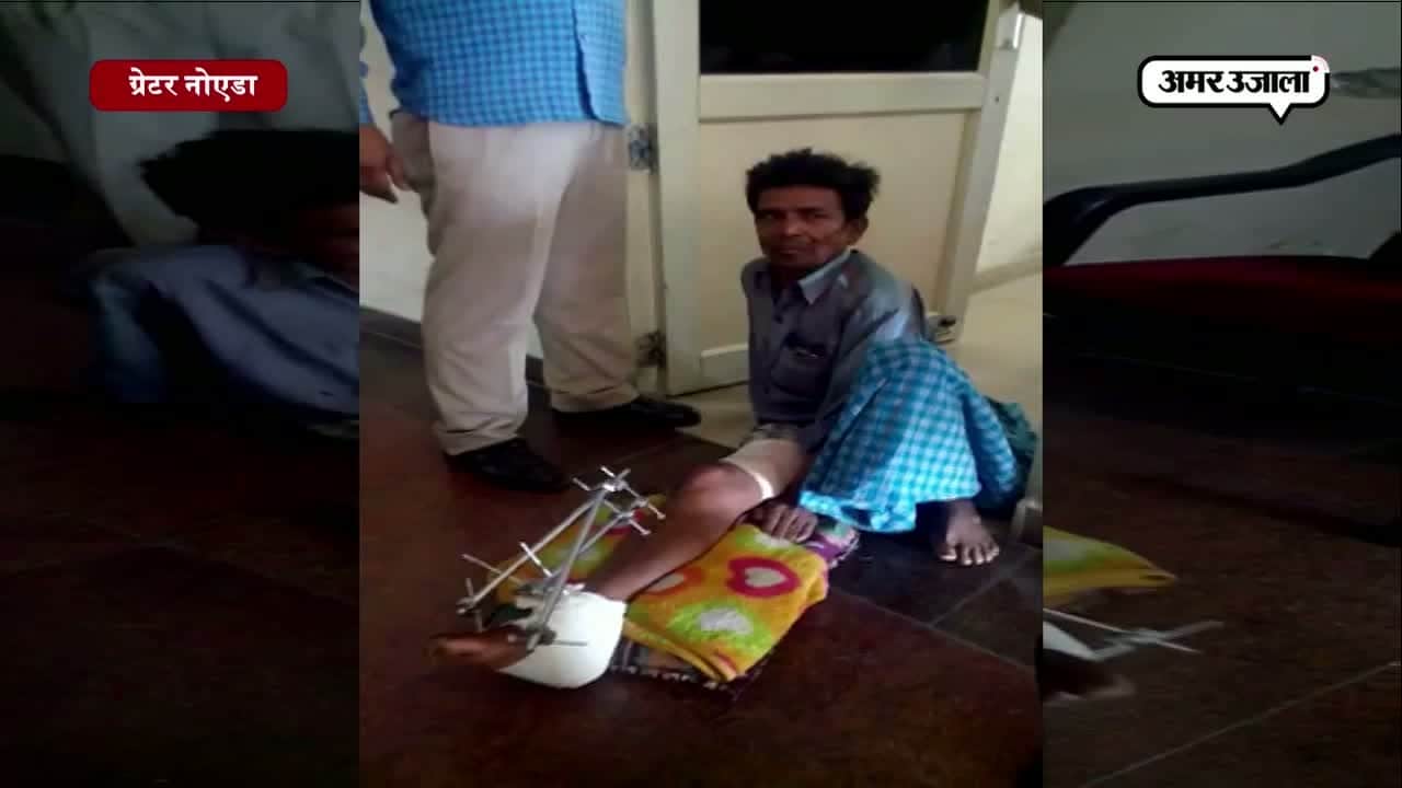 ग्रेटर नोएडा टूटी टांग 