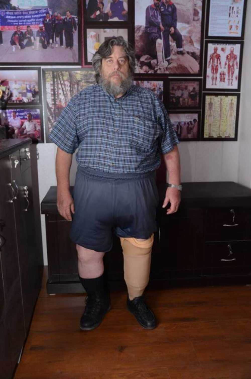 165 kg weighted man artificial leg