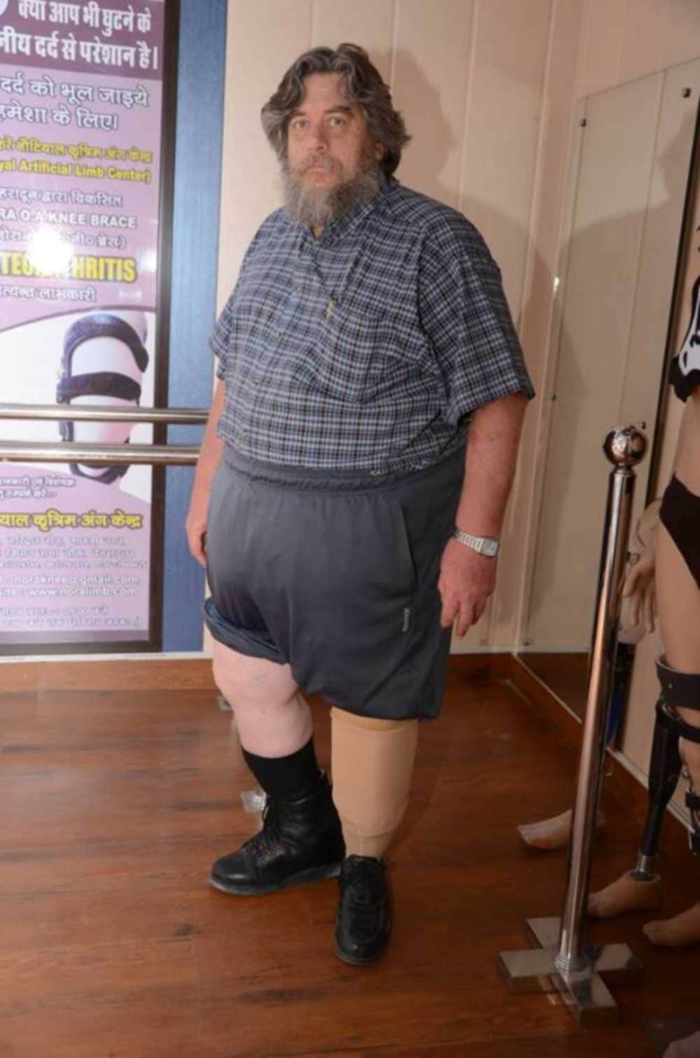 165 kg weighted man artificial leg
