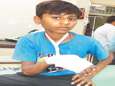 Cracked crackers, teenager injured in hand