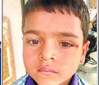 Teacher beaten student,s with sticks