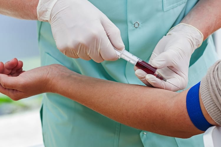 test fees hike in kgmu hospital
