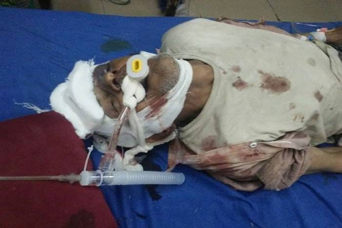 accident in kota