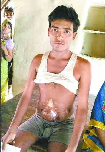 Case against three doctors in Kidney theft of youth