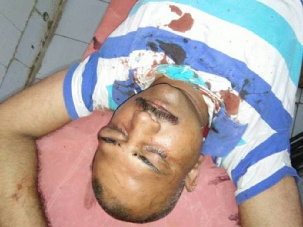 four people injured in car accident at nainital