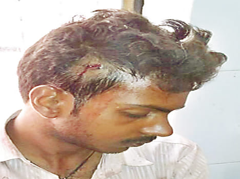 Road accidents, eight injured in road dispute