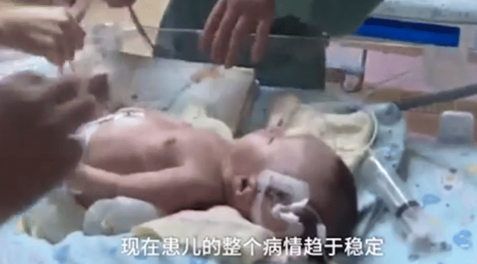 Dog saves newborn baby that buried alive 