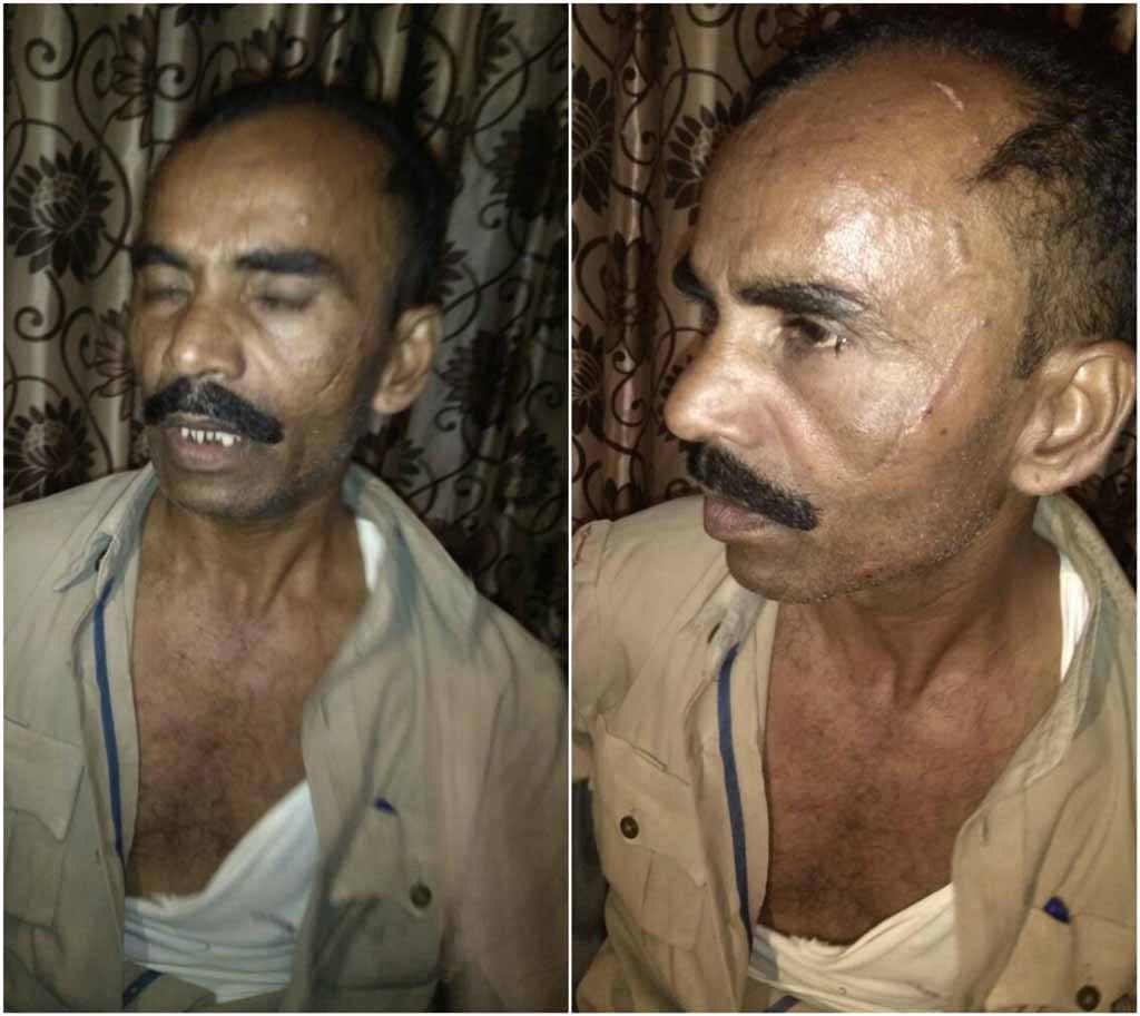 rpf beaten up police constable while he running for catch criminal