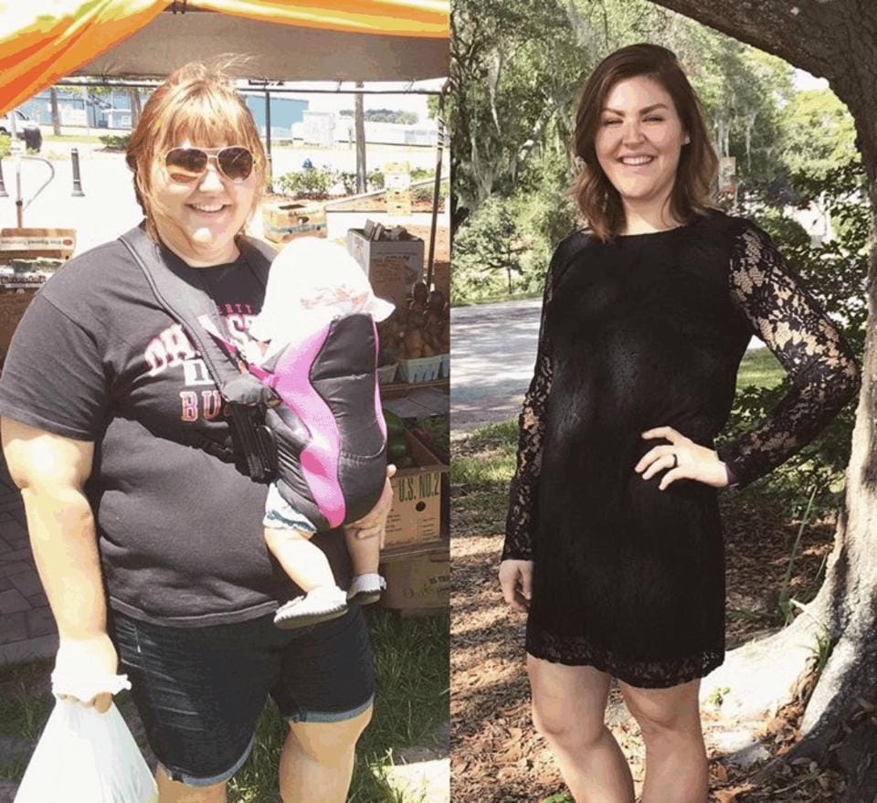 after refusing doctor’s advice, womenfat loses seven stone naturally 
