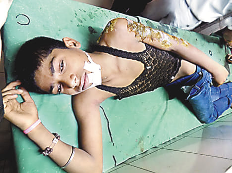 Two bikers injured by car collision
