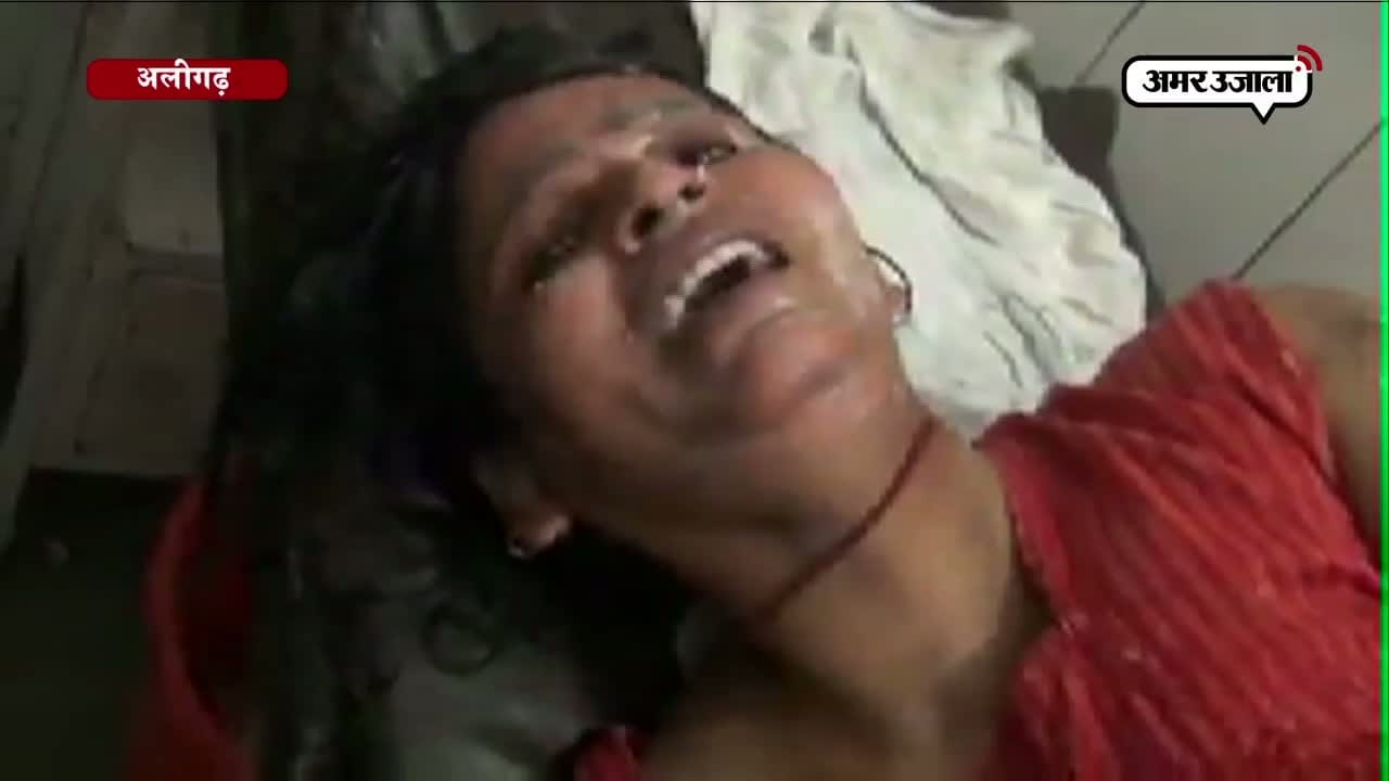 एसिड अटैक