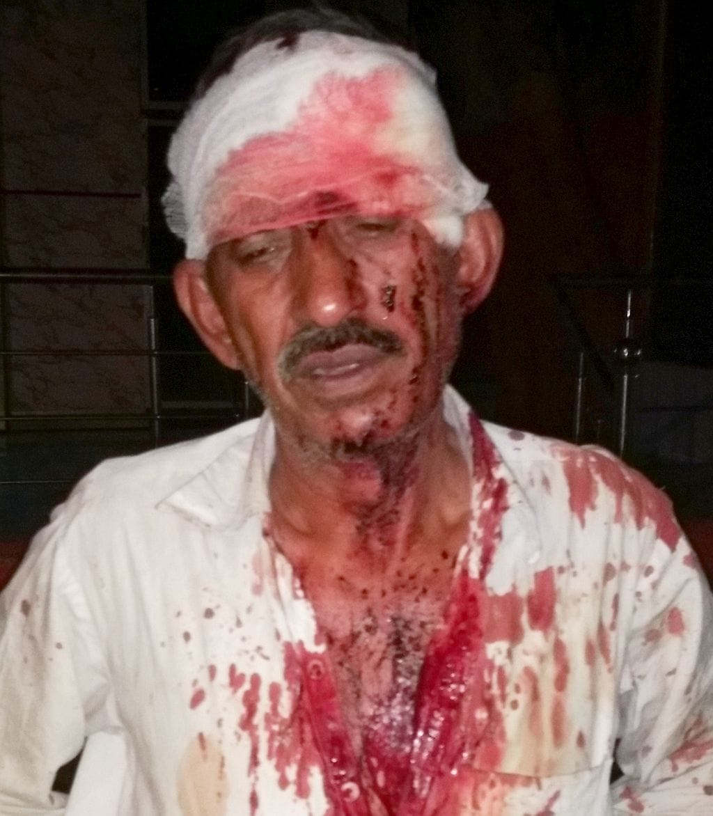 Wounded in the head of the elderly by throwing a bottle