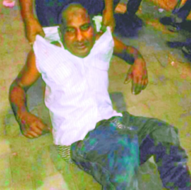  relative injured with scissor