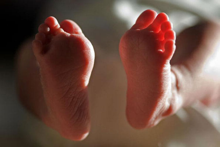 Three month old girl dead due to non treatment
