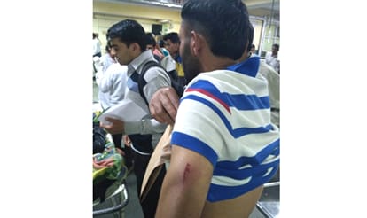 Riot at HP University Hostel, Five Admitted at IGMC Hospital.