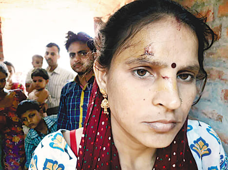 Panic of wild animal in Harpalpur katiyari