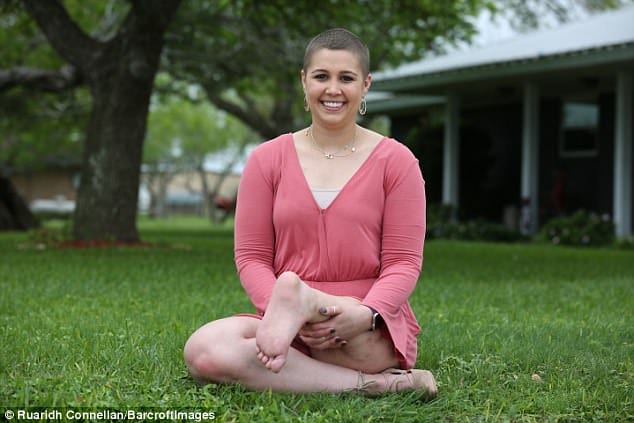 Miss Teen usa knee replaced with her own ANKLE
