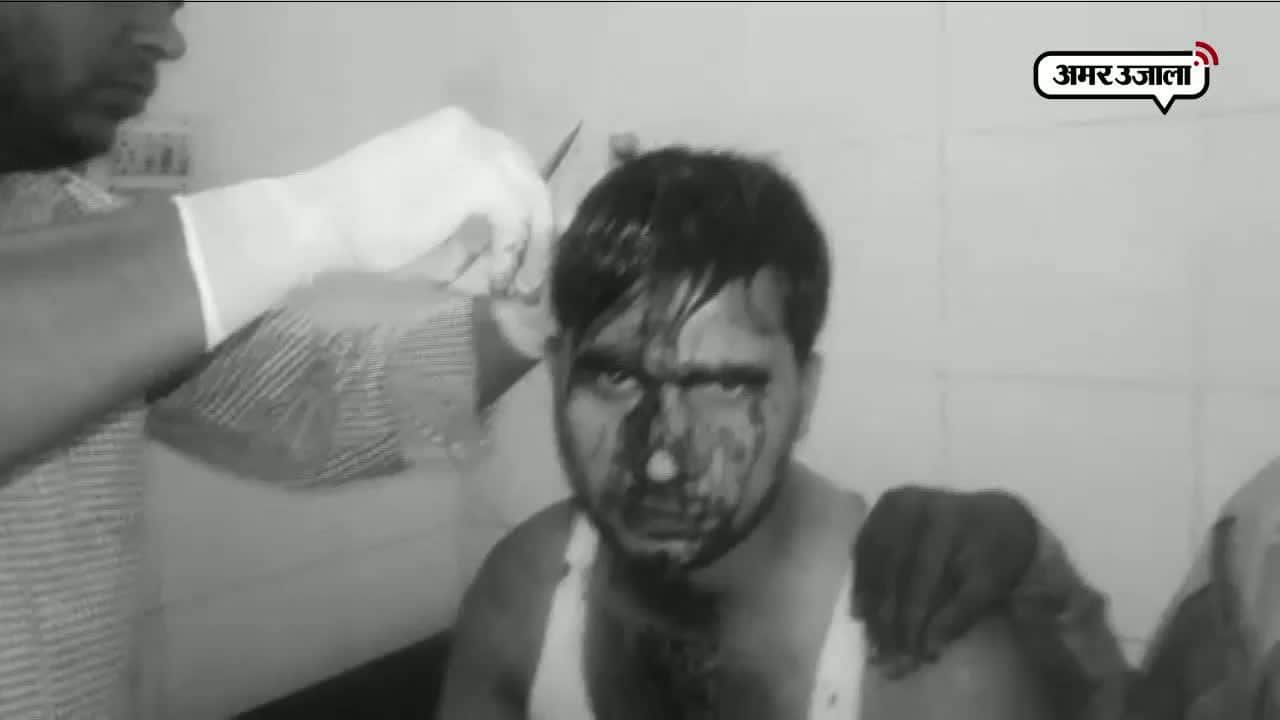 जीजा को किया लहुलुहान