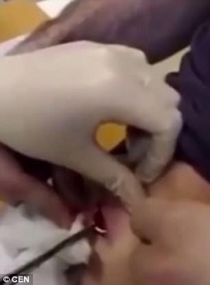 man propose to his nurse girlfriend by sealing a ring inside wounded abdomen