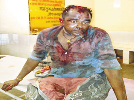 After killing the daughter-in-law, got pesticide jumped off the roof