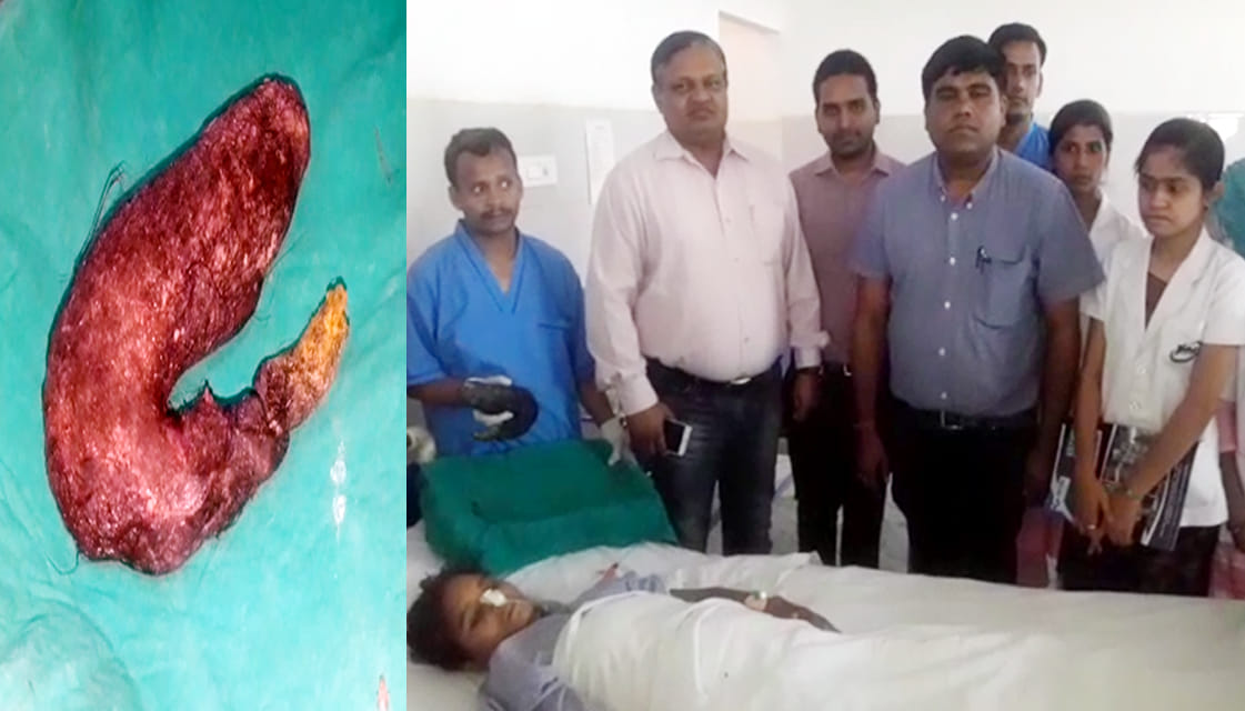 repressive syndrome disease operated in auraiya 