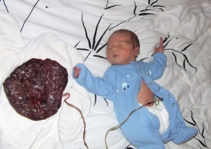 lotus birth in America