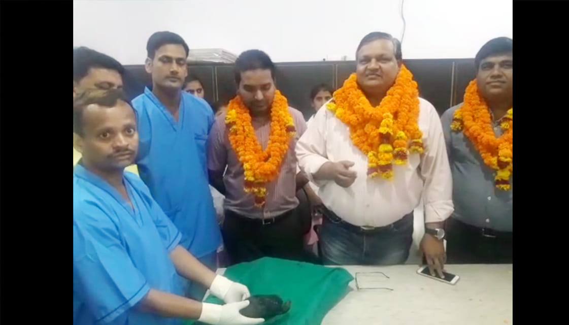 repressive syndrome disease operated in auraiya 