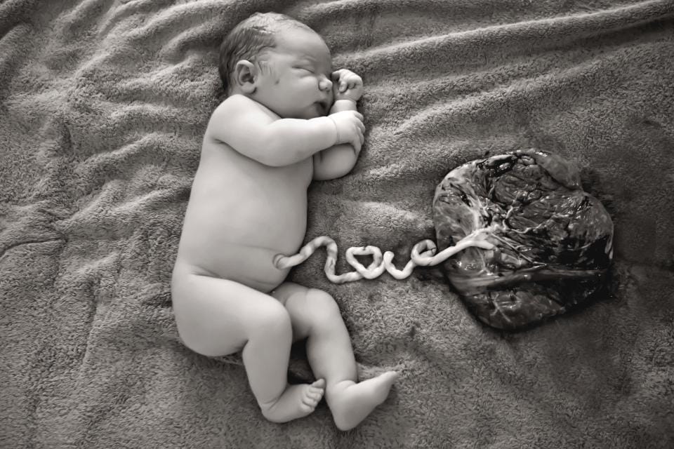 lotus birth in America