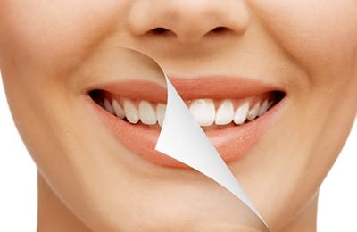  After 25 years long time A woman jaw can move up and down 