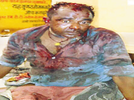 Bahu's assassination killed in Lucknow during treatment