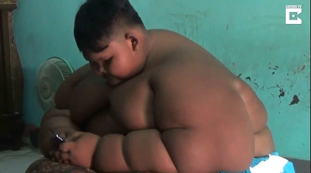 10 year old indonesian boy Arya Somantri, weight hit 30 STONE