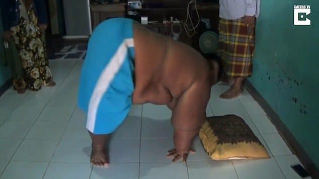 10 year old indonesian boy Arya Somantri, weight hit 30 STONE