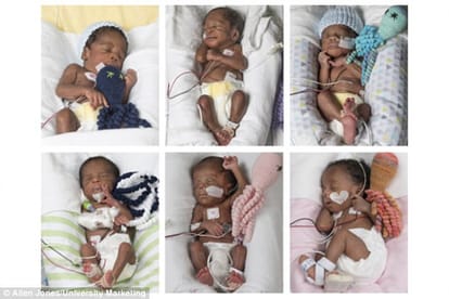 couple having sextuplets after 17 years at VCU medical center 