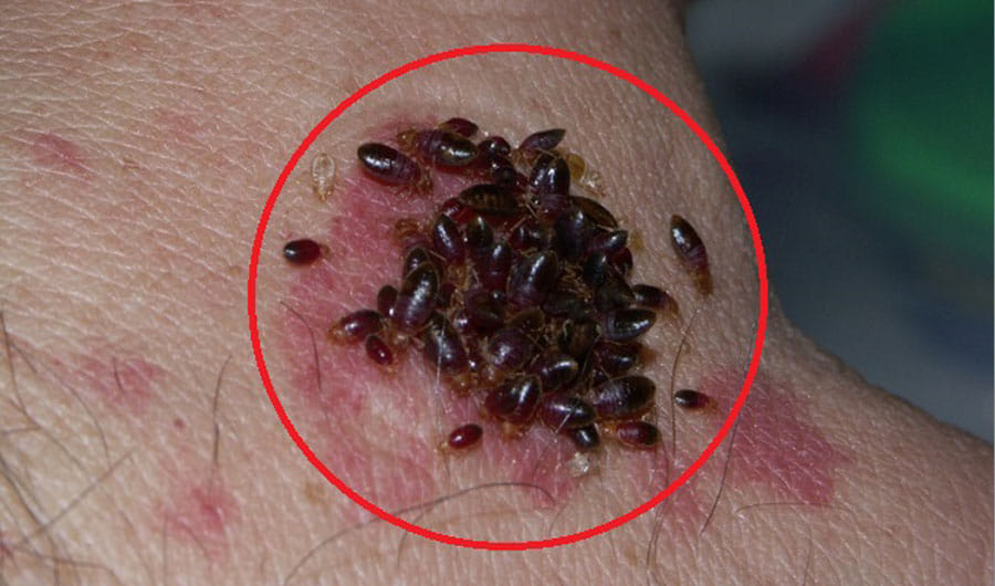 man suddenly died after biting ants, doctors discovered later is really baffled you