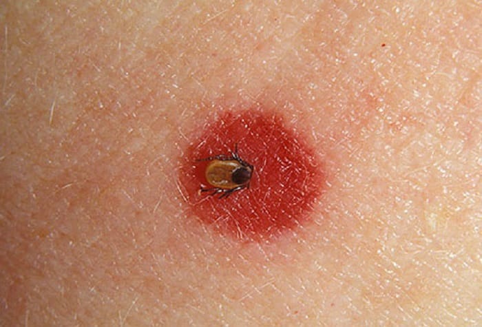 man suddenly died after biting ants, doctors discovered later is really baffled you