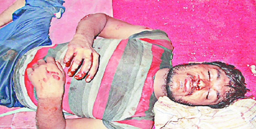 Two communities struggle in Baghpat, seven people including a woman were injured, force deployed