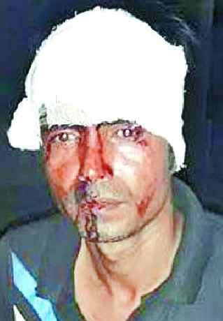 Two factions, four injured in land dispute