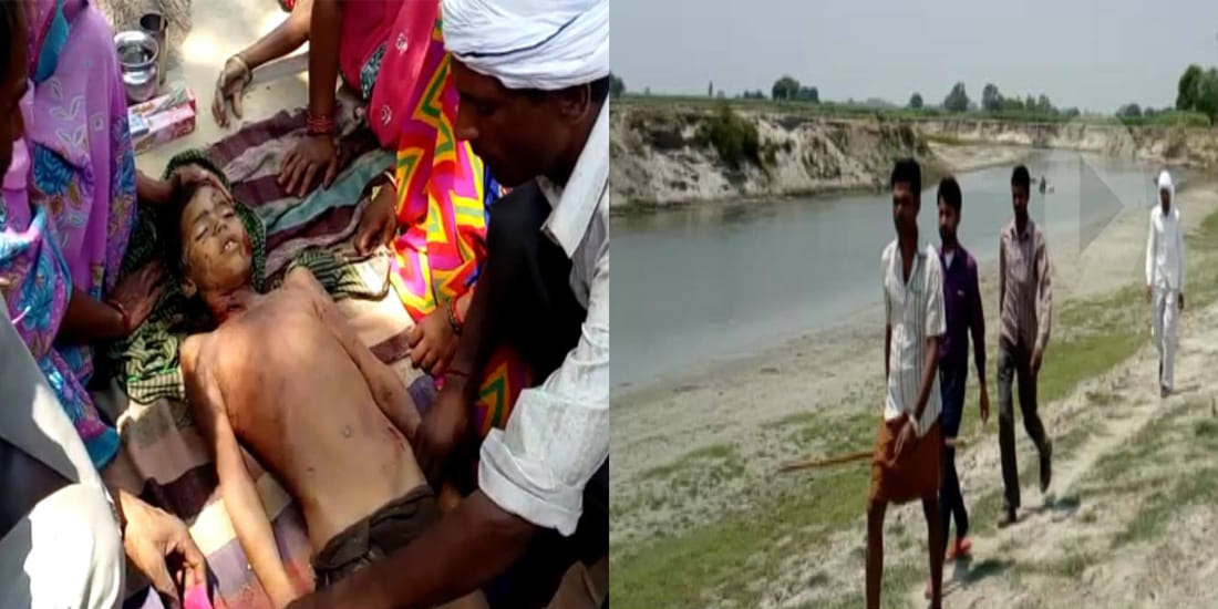 seven year old child dead dut to attack of wild dogs in kannauj