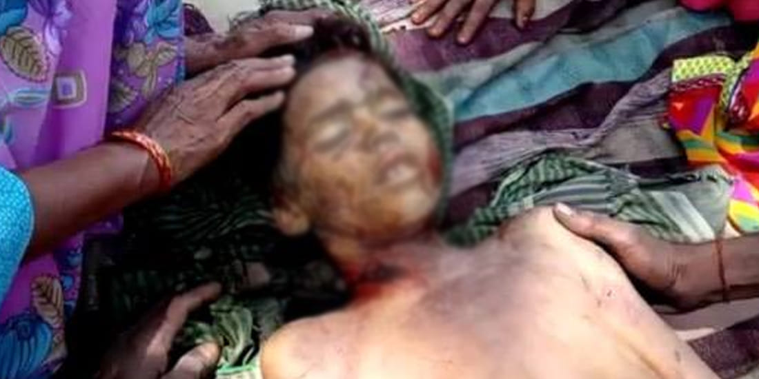seven year old child dead dut to attack of wild dogs in kannauj