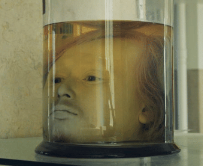 Human Head is preserved At an University Since 1841, reason is amazing