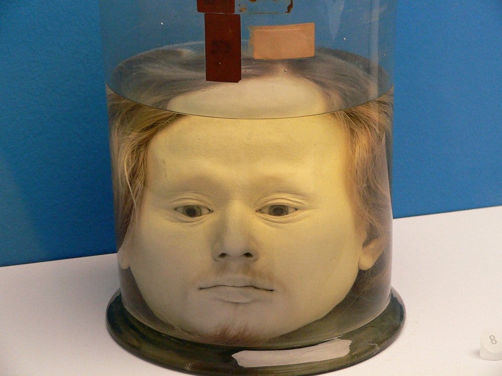 Human Head is preserved At an University Since 1841, reason is amazing