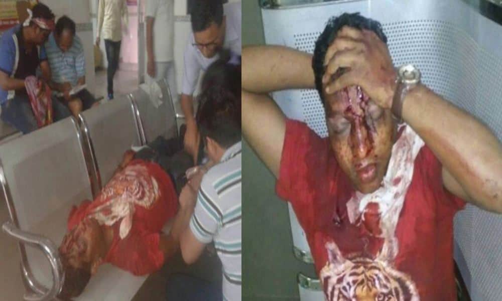 photos of road accident in nainital uttarakhand