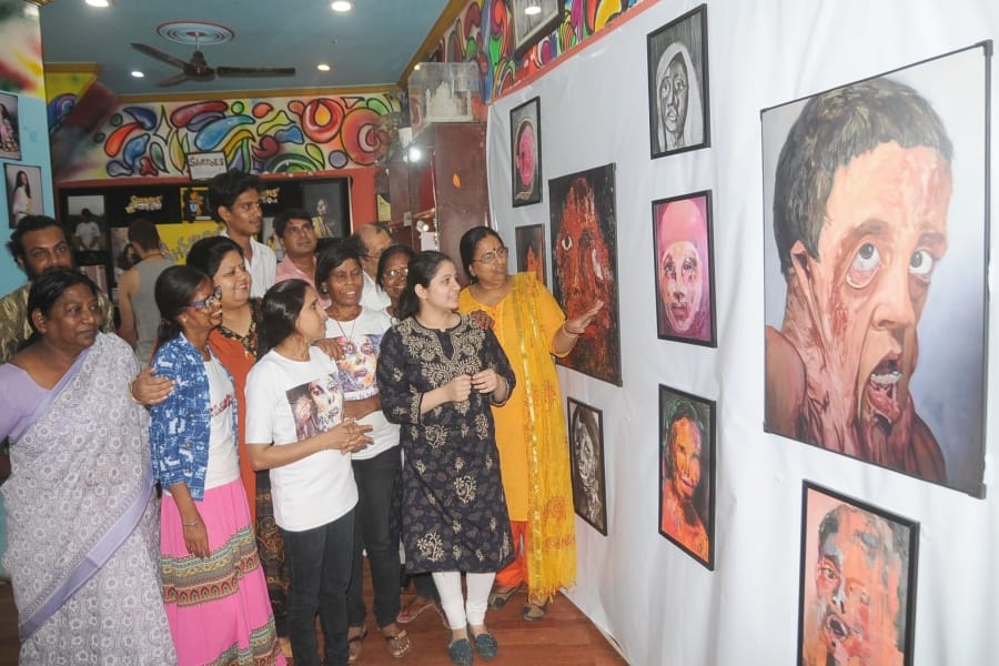 Acid attack victims Says on Ravan Dahan Agra News in Hindi