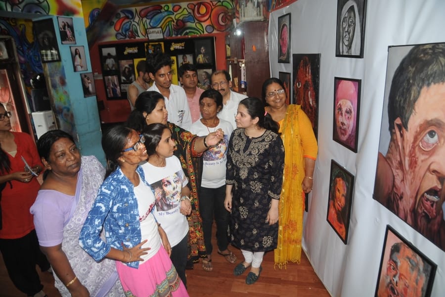 acid attack survivors story on canvas in sheroes hangout cafe in agra 