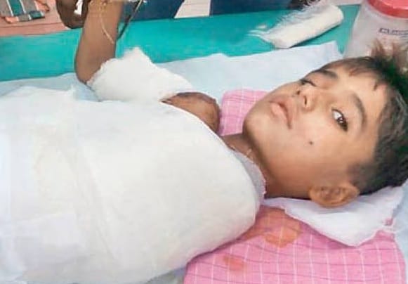 a boy lost his hand due to doctors in jodhpur