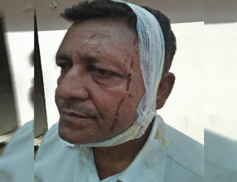 ex minister head injured in bus accident