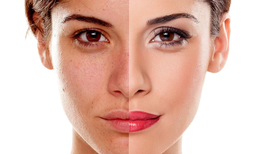 Wants to get rid of your wrinkled face then try this lady finger mask 