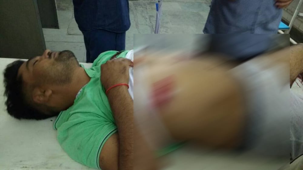 bjp leader shoot a man in rudrapur