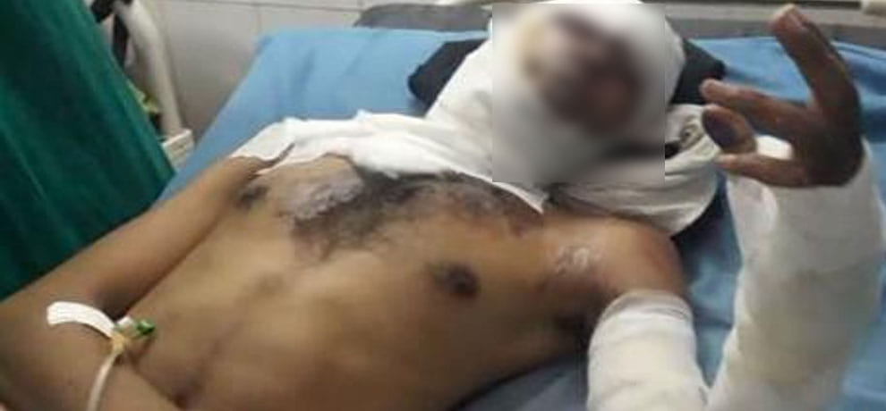 husband refused to shave wife threw hot water on him in UP's Aligarh