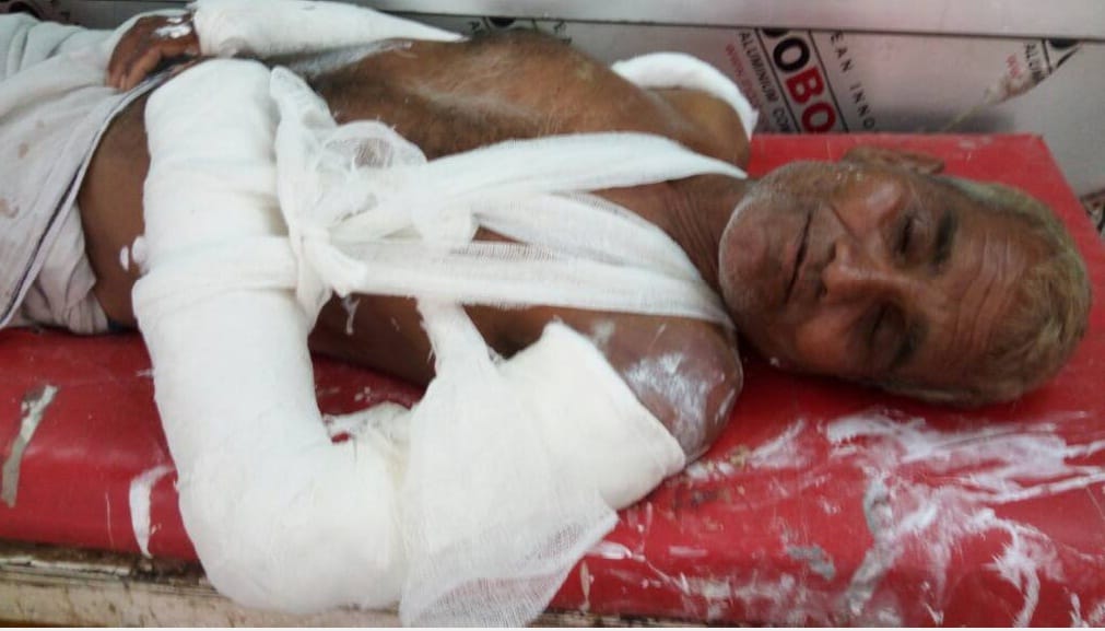 criminals beat to man, robbery